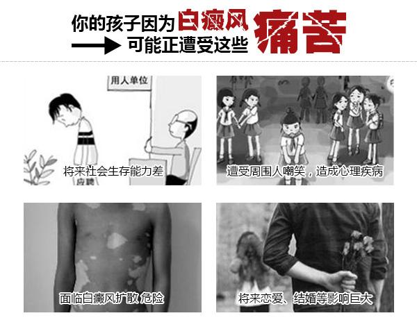 白癜风会遗传吗